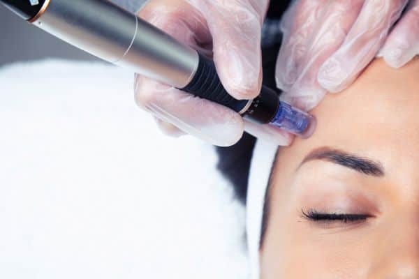 Explaining Total Skin Tightening Treatment and What to Expect 2 What Skin Concerns Can Total Skin Tightening Treatment Help With Weymouth?
